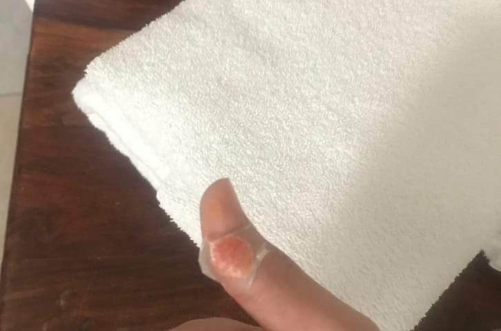 Time For The Beach! Oh Wait. Ouch, My Thumb Is Stuck In the Door