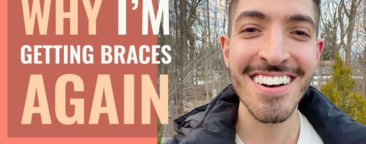 Why I’m Getting Braces… Again? Getting Started with Invisalign
