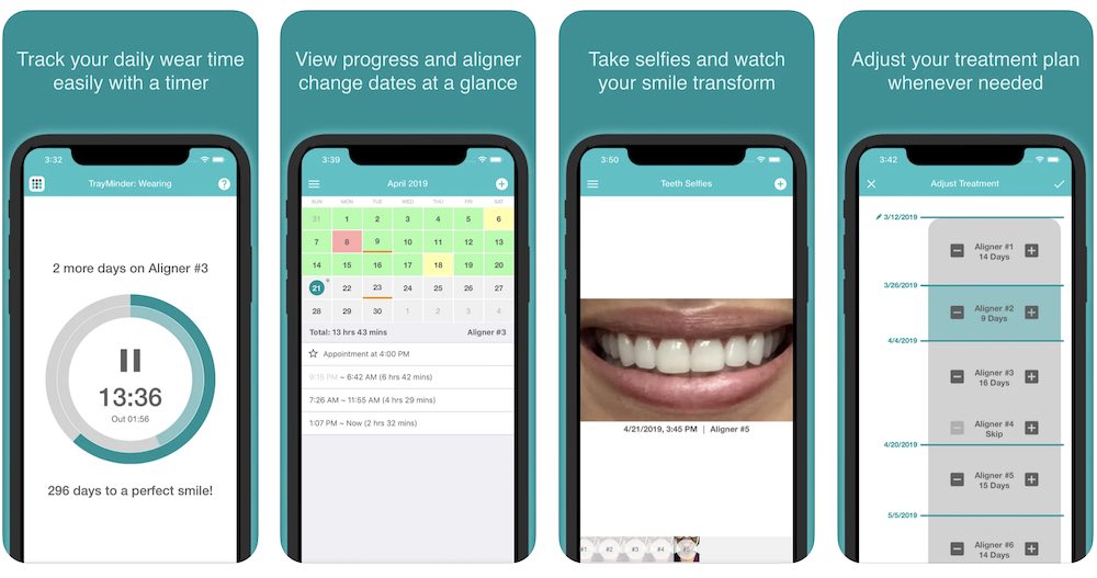 TrayMinder App for Invisalign