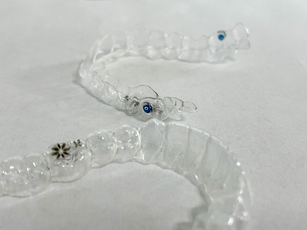 Invisalign Blue Dots: Wear Detectors